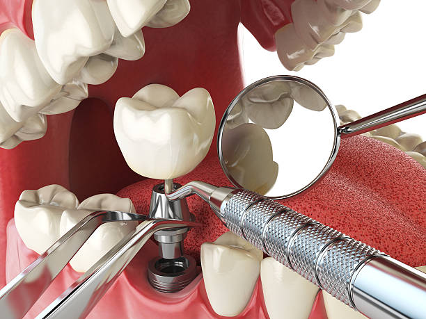 Best Emergency TMJ Treatment in Liolnton, NC