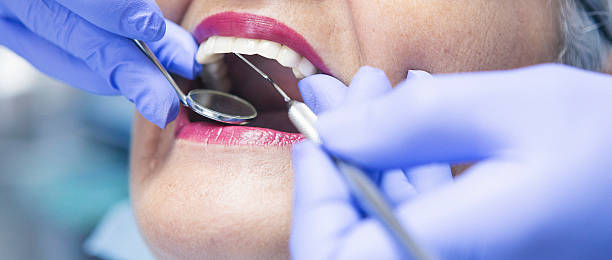 Best Emergency Root Canal Treatment in Liolnton, NC